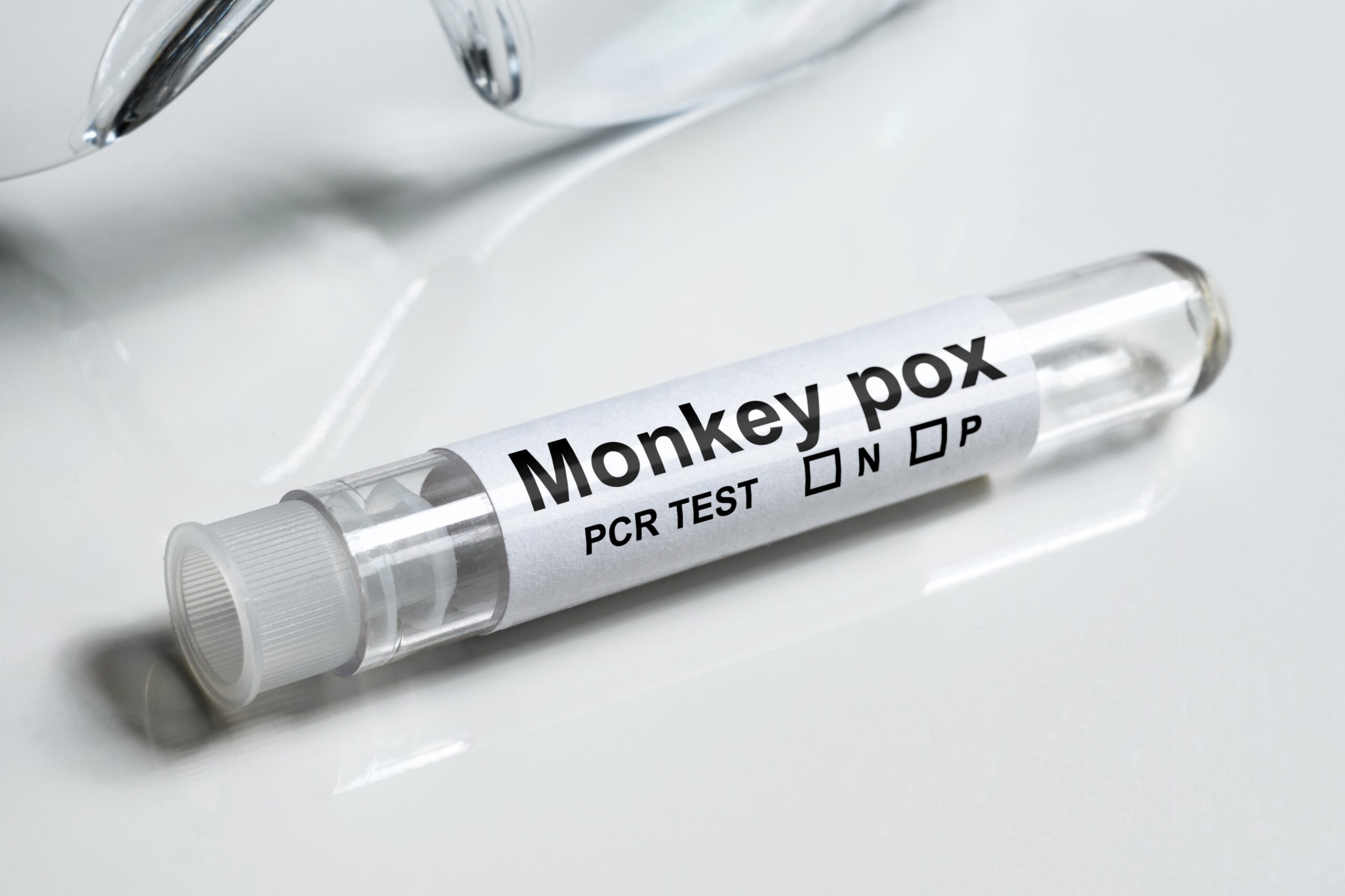 Monkey,Pox,Test,Tube,On,White,Table,Close-up.,Medical,Kit