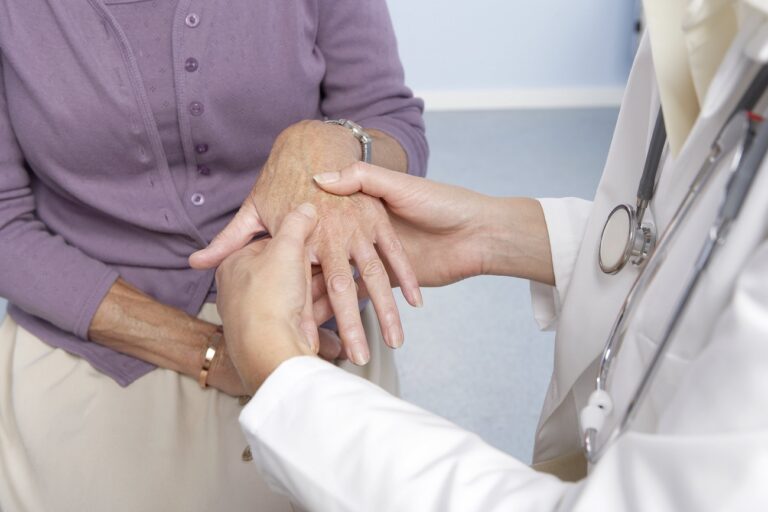 Rheumatoid arthritis, general practitioner examining patient and hand for signs of rheumatoid arthri